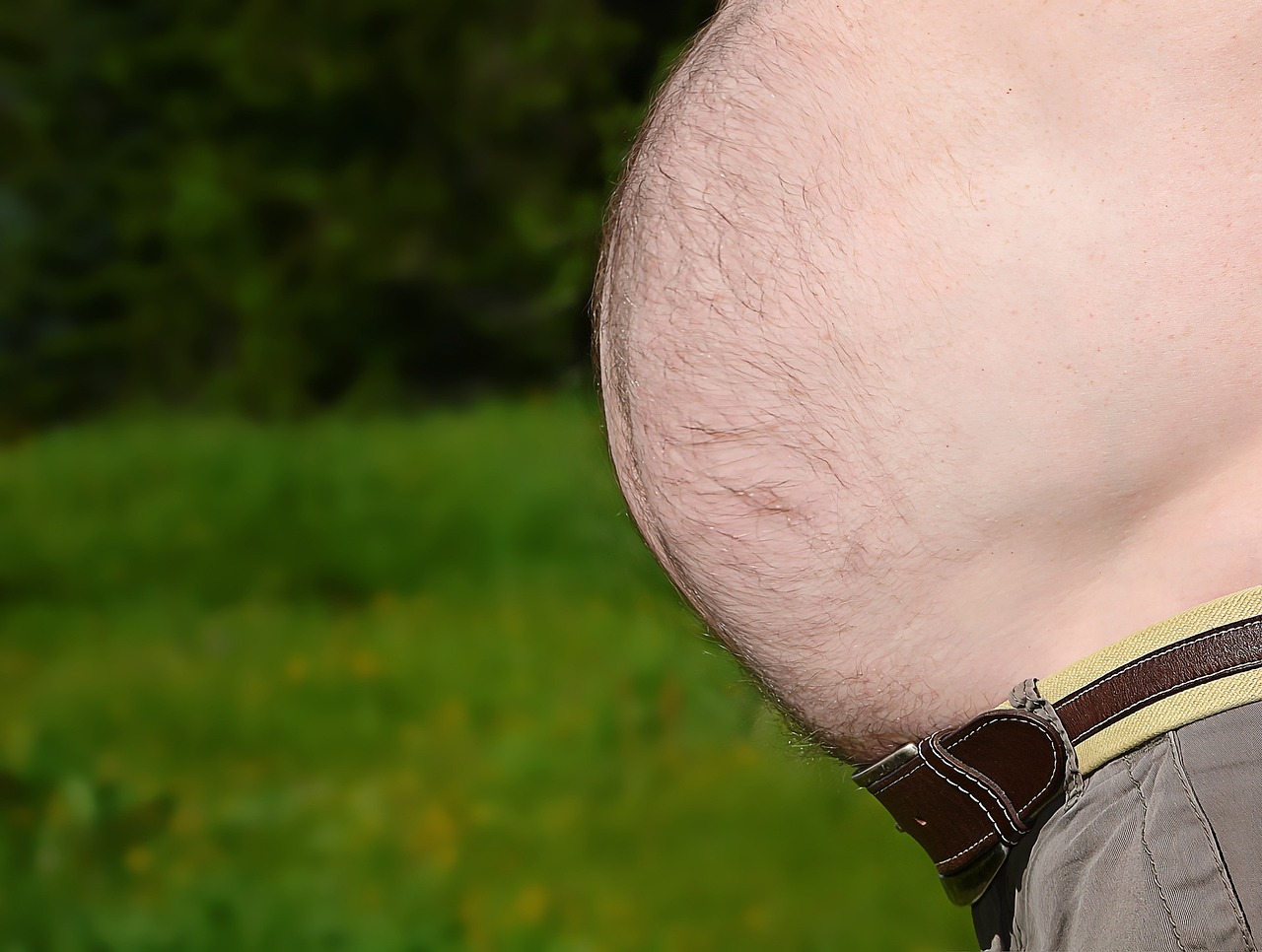 복부 거상
